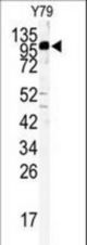 Western blot of KIF3C antibody in Y79 cell line lysates (35 ug/lane). HGK (arrow) was detected using the purified antibody.