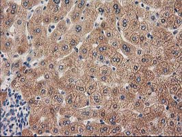 IHC of paraffin-embedded Human liver tissue using anti-GRHPR mouse monoclonal antibody. (Heat-induced epitope retrieval by 10mM citric buffer, pH6.0, 100C for 10min).