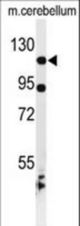 Western blot of KIF6 Antibody in mouse cerebellum tissue lysates (35 ug/lane). KIF6 (arrow) was detected using the purified antibody.