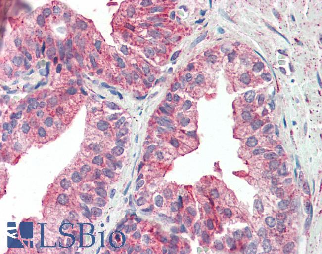 Anti-KIF6 antibody IHC staining of human prostate. Immunohistochemistry of formalin-fixed, paraffin-embedded tissue after heat-induced antigen retrieval.