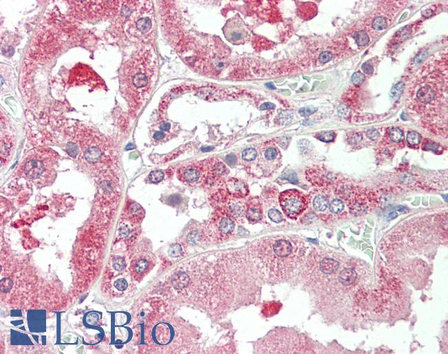 Anti-KIF6 antibody IHC staining of human kidney. Immunohistochemistry of formalin-fixed, paraffin-embedded tissue after heat-induced antigen retrieval. Antibody LS-B10297 concentration 5 ug/ml.
