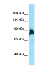 Western blot of Human HT1080. KIF7 antibody dilution 1.0 ug/ml.