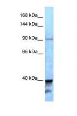 KIF7 antibody LS-C146000 Western blot of A549 Cell lysate. Antibody concentration 1 ug/ml.