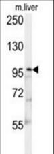 KIF9 Antibody western blot of mouse liver tissue lysates (15 ug/lane). The KIF9 antibody detected KIF9 protein (arrow).