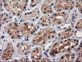 IHC of paraffin-embedded Human Kidney tissue using anti-GRHPR mouse monoclonal antibody. (Heat-induced epitope retrieval by 10mM citric buffer, pH6.0, 100C for 10min).