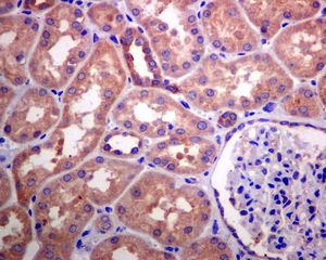 IHC of paraffin-embedded human kidney tissue using anti-KIFAP3 antibody.