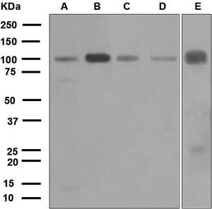 Western blot analysis on (A) HeLa, (B) SH-SY5Y, (C) C6, (D) 293T, and (E) fetal kidney lysates using anti-KIFAP3 antibody.