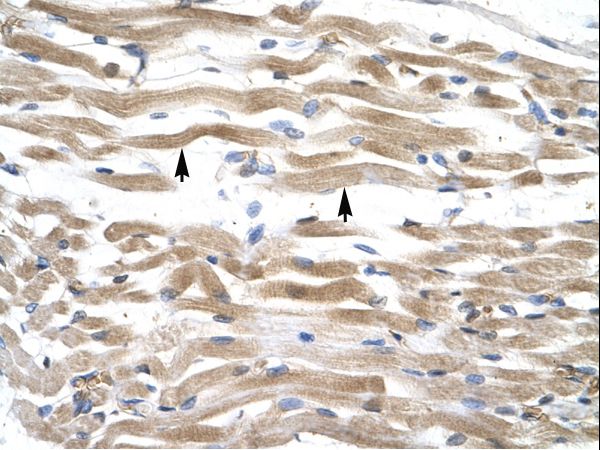 KIFC2 antibody LS-C31435 was used in IHC to stain formalin-fixed, paraffin-embedded human muscle.