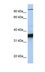 MCF7 cell lysate. Antibody concentration: 1.0 ug/ml. Gel concentration: 12%.