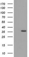 HEK293T cells were transfected with the pCMV6-ENTRY control (Left lane) or pCMV6-ENTRY GRHPR (Right lane) cDNA for 48 hrs and lysed. Equivalent amounts of cell lysates (5 ug per lane) were separated by SDS-PAGE and immunoblotted with anti-GRHPR.