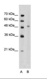 Jurkat Cell Lysate