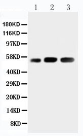WB of KIN17 / KIN antibody. Lane 1: Rat Skeletal Muscle Tissue Lysate. Lane 2: Human Placenta Tissue Lysate. Lane 3: Rat Testis Tissue Lysate.