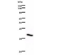 Western blot analysis of immunized recombinant protein, using anti-KIN monoclonal antibody.
