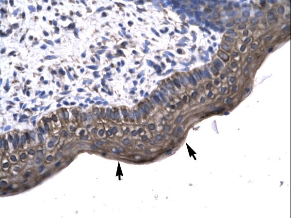 KIN antibody LS-C29695 was used in IHC to stain formalin-fixed, paraffin-embedded human spermatophore.