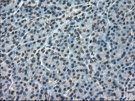 IHC of paraffin-embedded pancreas tissue using anti-FERMT2 mouse monoclonal antibody. (Dilution 1:50).
