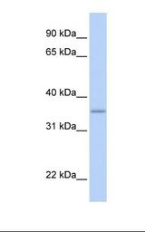 Fetal liver lysate. Antibody concentration: 1.0 ug/ml. Gel concentration: 12%.