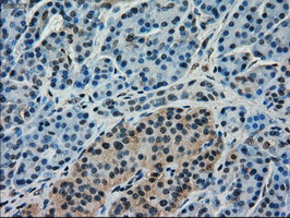 IHC of paraffin-embedded pancreas tissue using anti-FERMT2 mouse monoclonal antibody. (Dilution 1:50).