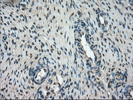 IHC of paraffin-embedded Ovary tissue using anti-FERMT2 mouse monoclonal antibody. (Dilution 1:50).