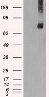 HEK293T cells were transfected with the pCMV6-ENTRY control (Left lane) or pCMV6-ENTRY FERMT2 (Right lane) cDNA for 48 hrs and lysed. Equivalent amounts of cell lysates (5 ug per lane) were separated by SDS-PAGE and immunoblotted with anti-FERMT2.