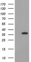 HEK293T cells were transfected with the pCMV6-ENTRY control (Left lane) or pCMV6-ENTRY GRHPR (Right lane) cDNA for 48 hrs and lysed. Equivalent amounts of cell lysates (5 ug per lane) were separated by SDS-PAGE and immunoblotted with anti-GRHPR.