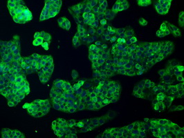 Immunofluorescent staining of HeLa cells using anti-FERMT2 mouse monoclonal antibody.
