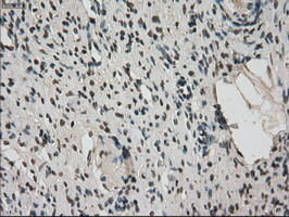 IHC of paraffin-embedded Ovary tissue using anti-FERMT2 mouse monoclonal antibody. (Dilution 1:50).