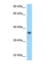 KIR2DL1 antibody LS-C146130 Western blot of HepG2 Cell lysate. Antibody concentration 1 ug/ml.