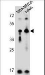 KIR2DL2 Antibody western blot of MDA-MB231,Jurkat cell line lysates (35 ug/lane). The KIR2DL2 antibody detected the KIR2DL2 protein (arrow).
