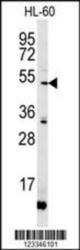 KIR2DL2 Antibody (C-term) Western blot analysis in HL-60 cell line lysates (15 ug/lane). This demonstrates the KIR2DL2 antibody detected the KIR2DL2 protein (arrow).