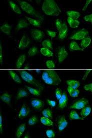 Immunofluorescence analysis of HepG2 cell using KIR2DL3 antibody. Blue: DAPI for nuclear staining.