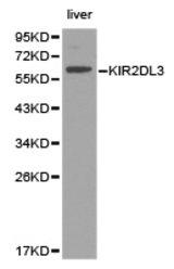 Western blot of extracts of liver cell lines, using KIR2DL3 antibody.