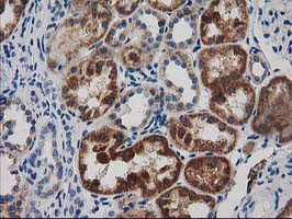 IHC of paraffin-embedded Human Kidney tissue using anti-GRHPR mouse monoclonal antibody.