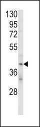 Western blot of KIR2DL4 Antibody in MDA-MB231 cell line lysates (35 ug/lane). KIR2DL4 (arrow) was detected using the purified antibody.