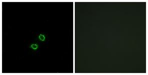 Immunofluorescence of A549 cells, using KIR2DL5B Antibody. The picture on the right is treated with the synthesized peptide.