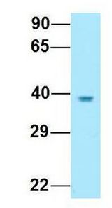 KIR2DL5A / KIR2DL5 antibody Western Blot of Human Fetal Kidney. Antibody Dilution: 1.0 ug/ml. Antibody dilution: 1 ug/ml.