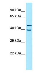 KIR2DL5A / KIR2DL5 antibody Western Blot of MCF7.