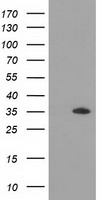 HEK293T cells were transfected with the pCMV6-ENTRY control (Left lane) or pCMV6-ENTRY GRHPR (Right lane) cDNA for 48 hrs and lysed. Equivalent amounts of cell lysates (5 ug per lane) were separated by SDS-PAGE and immunoblotted with anti-GRHPR.