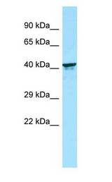 KIR2DL5B antibody Western Blot of Fetal kidney.