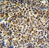 KIR2DL5B Antibody IHC of formalin-fixed and paraffin-embedded tonsil tissue followed by peroxidase-conjugated secondary antibody and DAB staining.