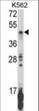 Western blot of KIR2DL5B Antibody in K562 cell line lysates (35 ug/lane). KIR2DL5B (arrow) was detected using the purified antibody.