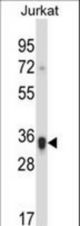 KIR2DS1 Antibody western blot of Jurkat cell line lysates (35 ug/lane). The KIR2DS1 antibody detected the KIR2DS1 protein (arrow).