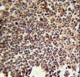 KIR2DS3 Antibody immunohistochemistry of formalin-fixed and paraffin-embedded human spleen tissue followed by peroxidase-conjugated secondary antibody and DAB staining.