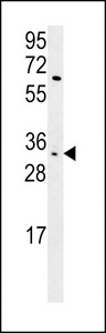 KIR2DS3 Antibody western blot of HL-60 cell line lysates (15 ug/lane). The KIR2DS3 antibody detected the KIR2DS3 protein (arrow).