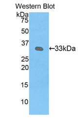 Western blot of recombinant KIR2DS4.