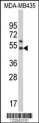 Western blot analysis of KIR2DS4 Antibody (Center) in MDA-MB435 cell line lysates (35 ug/lane). KIR2DS4 (arrow) was detected using the purified Pab.(2 ug/ml)