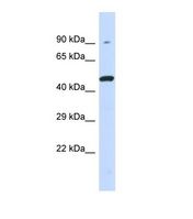 Western blot of Human 293T. KIR3DL1 antibody dilution 1.0 ug/ml.