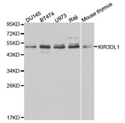 Western blot analysis of extracts of various cell lines, using KIR3DL1 antibody.