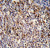 Formalin-fixed and paraffin-embedded human tonsil reacted with KIR3DL3 Antibody , which was peroxidase-conjugated to the secondary antibody, followed by DAB staining. This data demonstrates the use of this antibody for immunohistochemistry; clinical relevance has not been evaluated.