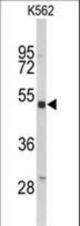 Western blot of KIR3DL3 Antibody in K562 cell line lysates (35 ug/lane). KIR3DL3 (arrow) was detected using the purified antibody.