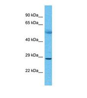 Western blot of Human Lung Tumor. KIR3DS1 antibody dilution 1.0 ug/ml.
